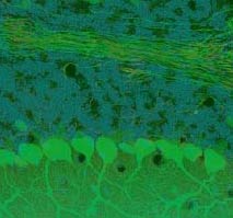 cerebellum.jpg